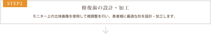 STEP2 修復歯の設計・加工