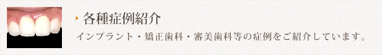 各種症例紹介 インプラント・矯正歯科・審美歯科等の症例をご紹介しています。