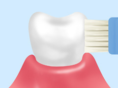 ブラッシング指導