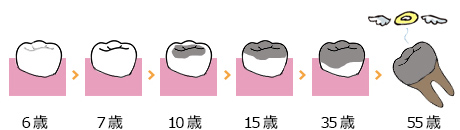 痛い時だけ治療する歯のイメージ